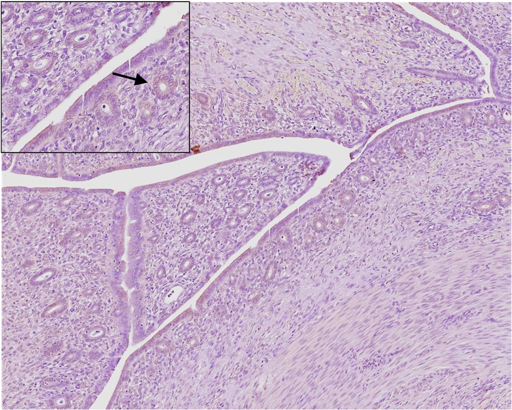 Figure 5a - Normal Endometrium COX-2