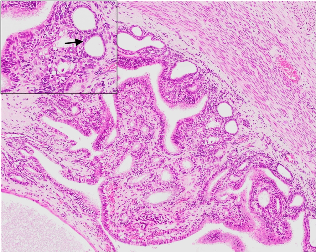 Figure 2a - Grade 1