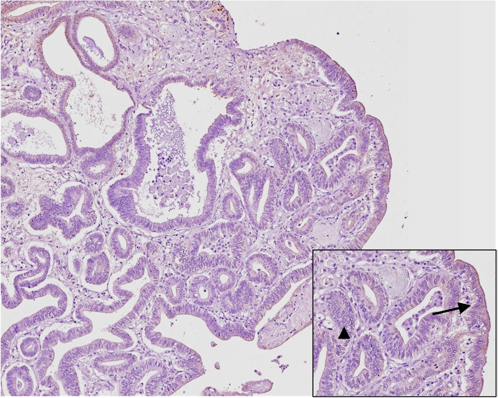 Figure 4a - Weak Staining