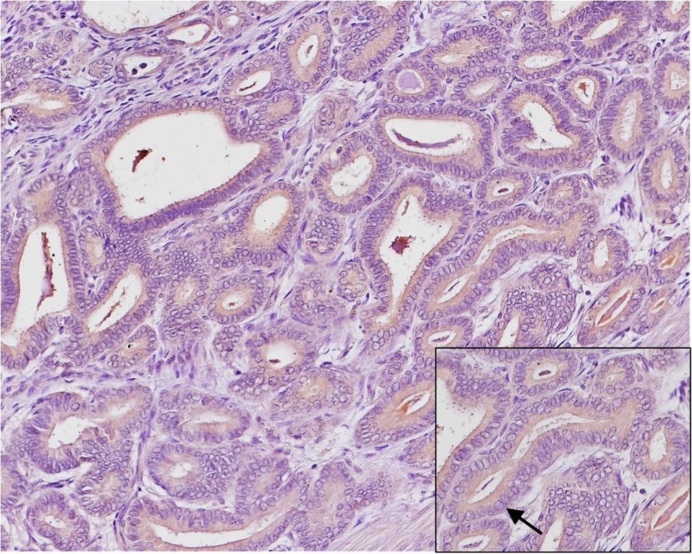 Figure 4b - Moderate Staining